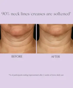 Age Reverse Toning Neck Cream