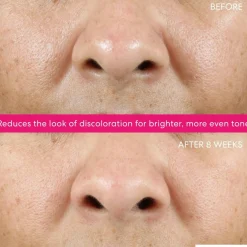 Ageless Phyto-AHA Radiance Facial