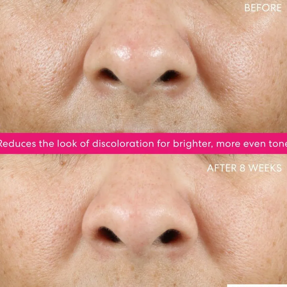 Ageless Phyto-AHA Radiance Facial