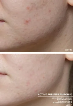 Ampoule Concentrates Active Purifier