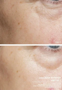 Ampoule Concentrates Collagen Booster