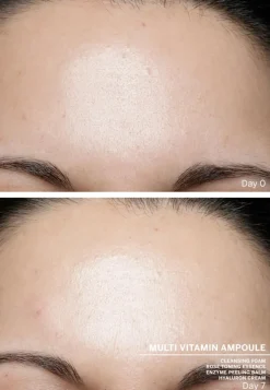 Ampoule Concentrates Multi Vitamin