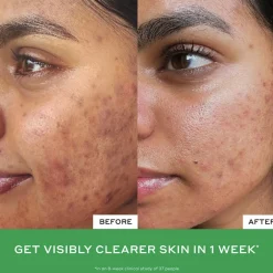 BALANCE Daily D-Clog Pore-Clearing Cleanser