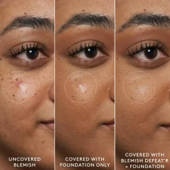 Blemish Defeat’r BHA Spot-Targeting Gel