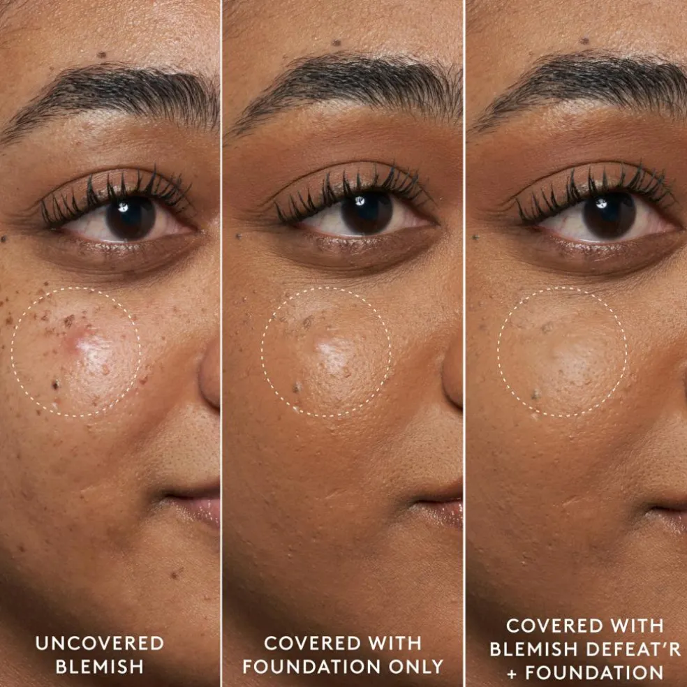 Blemish Defeat’r BHA Spot-Targeting Gel