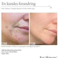 Calm Face Creme SPF 30