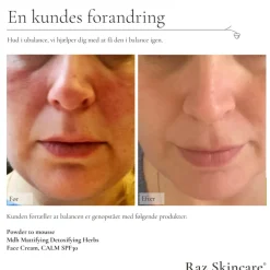 Calm Face Creme SPF 30