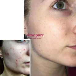 CIT Face Roller Platinum Kit