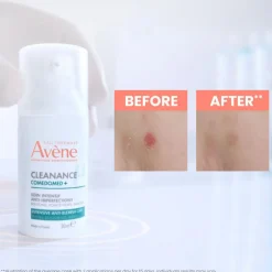 Cleanance Comedomed Anti-Blemishes Cream