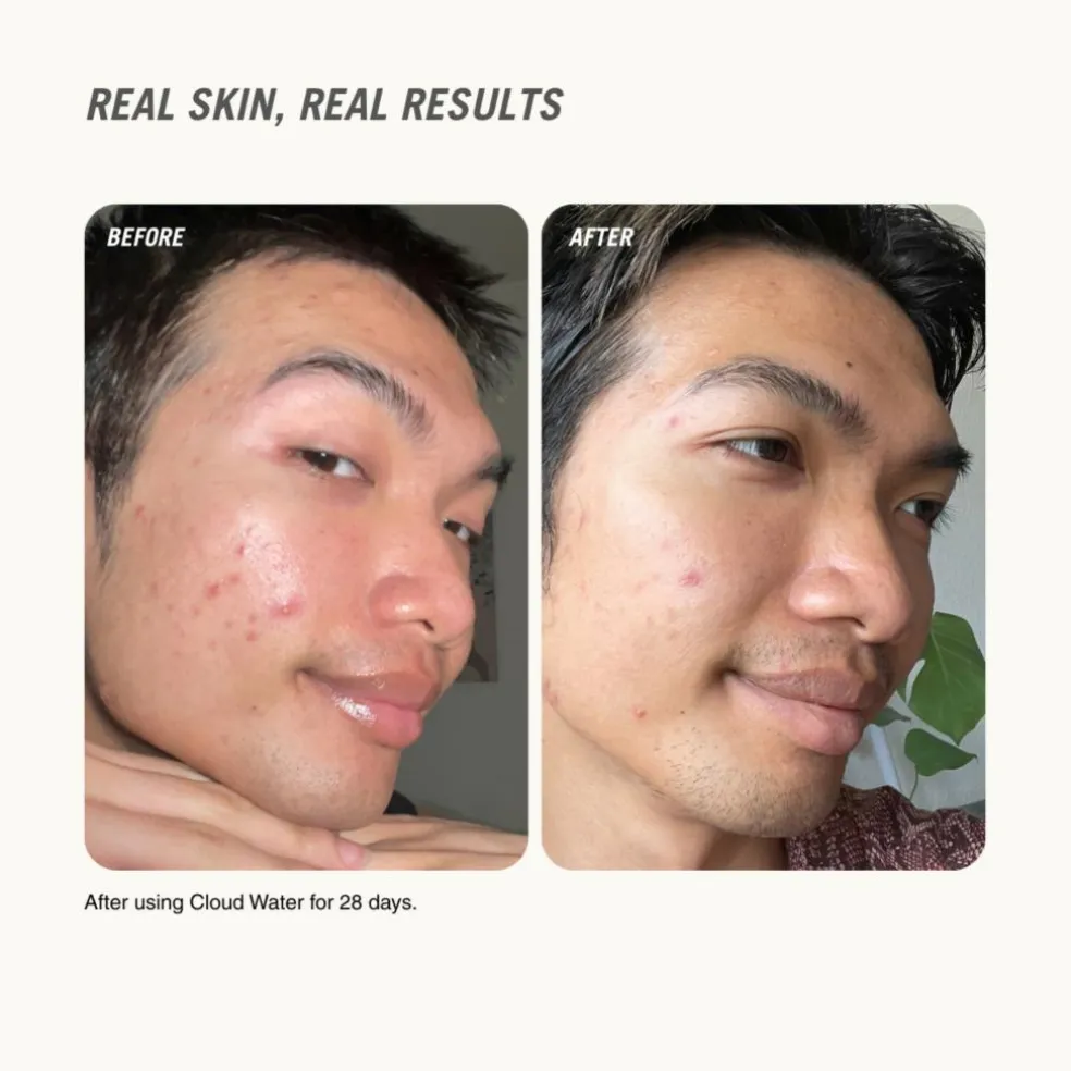 Cloud Water Gentle Exfoliating BHA Toner