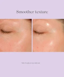 Daily Resurfacing Peel