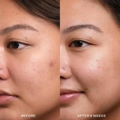 Dewtopia 20% Acid Treatment