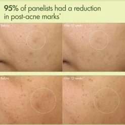 Dr. Weil Mega-Mushroom Dark Spot Correcting Brightening Moisturizer