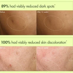 Dr. Weil Mega-Mushroom Dark Spot Correcting Brightening Serum