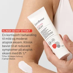 Eczema Cream