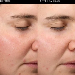 Exosome Hydro-Glow Complex