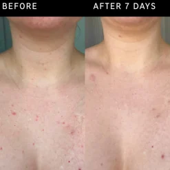 Glycolic Acid Exfoliating Body Stick