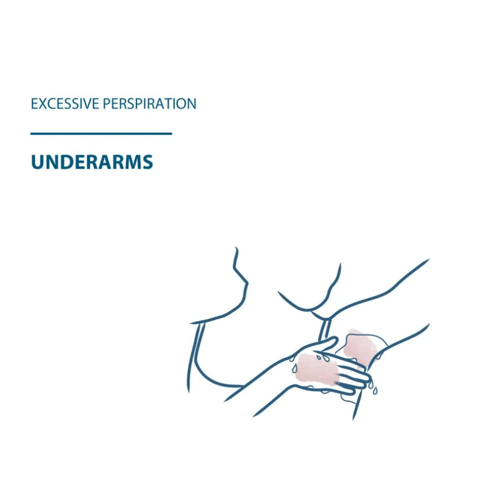 Hidrosis Control Antiperspirant Roll-On