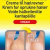 Hælcreme