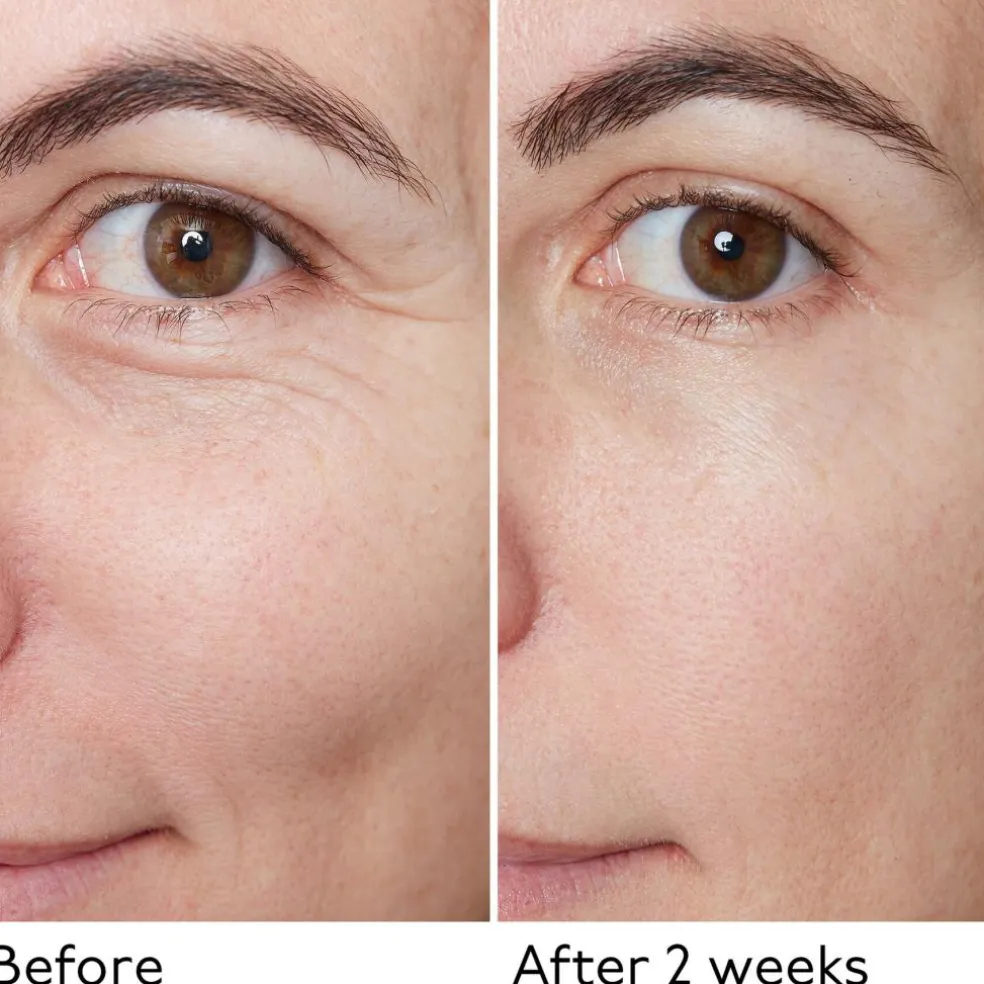 Hyaluronic Global Serum