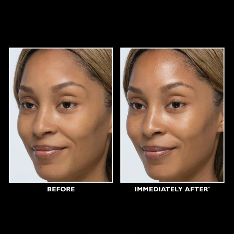 Instant FIRMx® Glow-Filter Priming