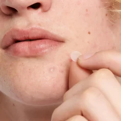 Invisible Pimple Patches