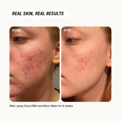 Moon Balm Deeply Hydrating Moisturiser