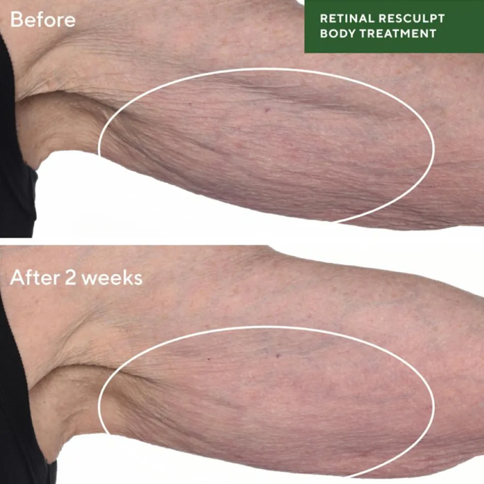 Murad Retinal Resculpt Body Treatment