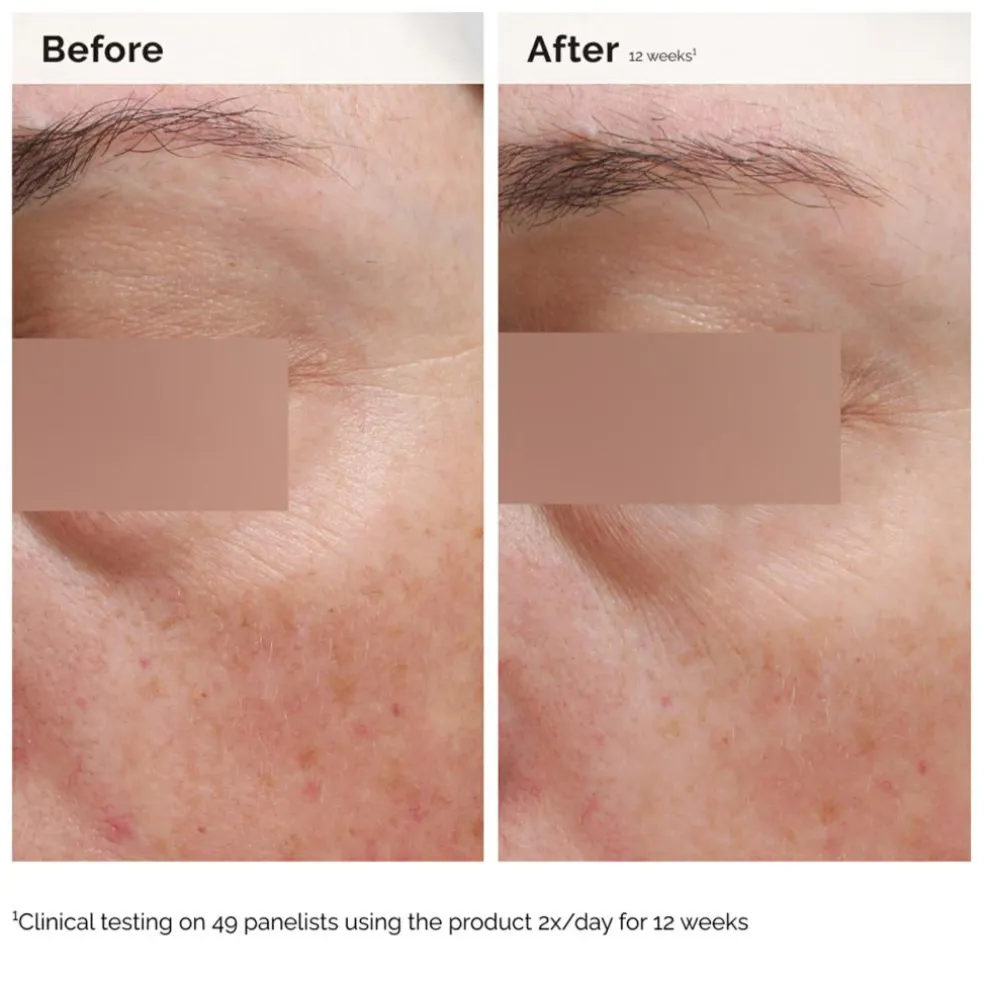 Niacinamide 5% Face and Body Emulsion