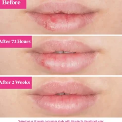 Plumping Lip Mask