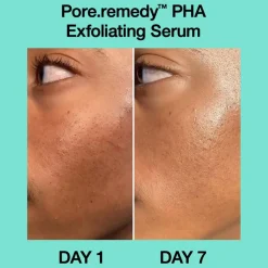 Pore·remedy PHA Exfoliating Serum