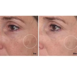 Rapid Dark Spot Correcting Serum
