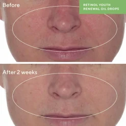 Retinol Youth Renewal Oil Drops