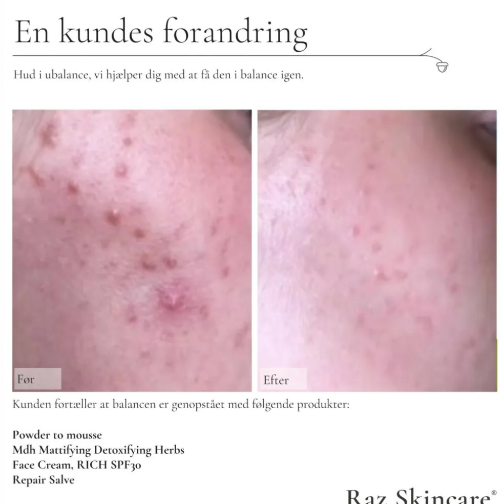 Rich Face Creme SPF 30