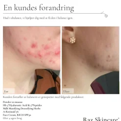 Rich Face Creme SPF 30