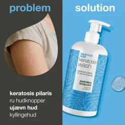Salicylic Acid Keratosis Wash