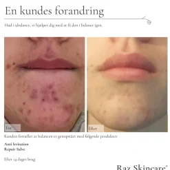 Skincare Repair Parfumefri