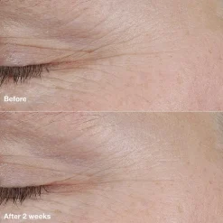 Smart Clinical Repair AM/PM Retinoid Balm