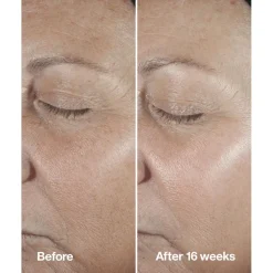 Smart Clinical Repair Wrinkle Correcting Serum