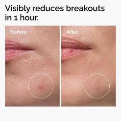 Sulfur 10% Powder-to-Cream Concentrate