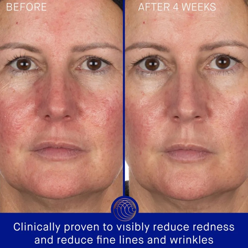 The Hydrogel Face Mask