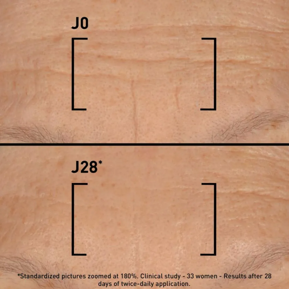 Time-Filler 5 XP Cream