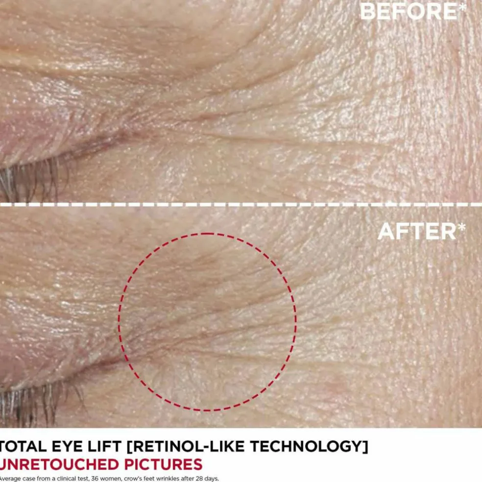 Total Eye Lift