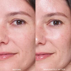 Transform Dewtopia 25% Acid Flash Facial