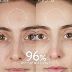 Vinopure Purifying Gel Cleanser