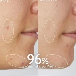 Vinopure Purifying Gel Cleanser