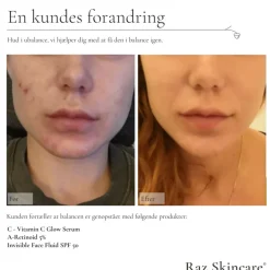 Vitamin C Glow Serum